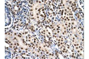 Image no. 2 for anti-Ras Suppressor Protein 1 (RSU1) (C-Term) antibody (ABIN321436) (RSU1 antibody  (C-Term))