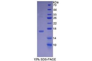 SDS-PAGE (SDS) image for Midkine (Neurite Growth-Promoting Factor 2) (MDK) (AA 22-140) protein (His tag) (ABIN1080296) (Midkine Protein (AA 22-140) (His tag))