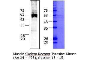 Quality Control Images: Western Blotting + SDS-PAGE (MUSK Protein (AA 24-495) (His tag))