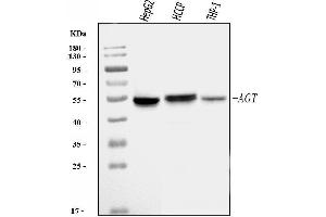 Western blot analysis of Angiotensinogen/AGT using anti-Angiotensinogen/AGT antibody (ABIN7601392).