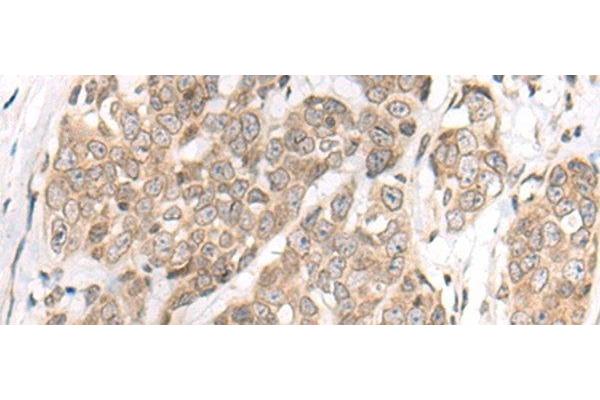 Meiosis 1 Associated Protein (M1AP) antibody