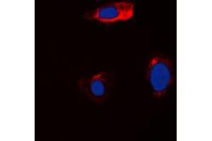 Immunofluorescent analysis of Cystatin 11 staining in HEK293T cells. (CST11 antibody  (Center))