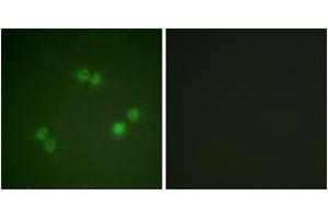 Immunofluorescence analysis of A549 cells, using SF1 (Phospho-Ser82) Antibody. (Splicing Factor 1 antibody  (pSer82))