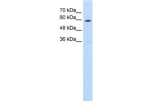WB Suggested Anti-SLC11A1 Antibody Titration:  1. (SLC11A1 antibody  (C-Term))