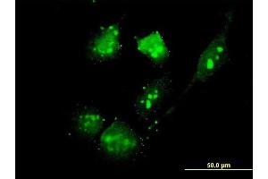 Immunofluorescence of monoclonal antibody to THG-1 on HeLa cell. (TSC22D4 antibody  (AA 1-395))