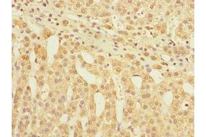 Immunohistochemistry of paraffin-embedded human adrenal gland tissue using ABIN7153881 at dilution of 1:100 (GLP2R antibody  (AA 1-180))