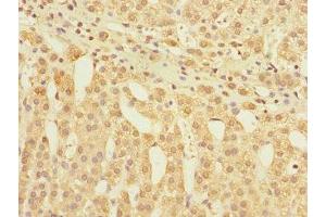 Immunohistochemistry of paraffin-embedded human adrenal gland tissue using ABIN7153881 at dilution of 1:100 (GLP2R antibody  (AA 1-180))