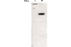 Image no. 1 for anti-Signal Transducer and Activator of Transcription 2, 113kDa (STAT2) (N-Term), (pTyr690) antibody (ABIN401443) (STAT2 antibody  (N-Term, pTyr690))