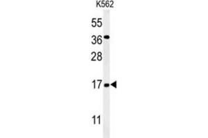 Western Blotting (WB) image for anti-N(alpha)-Acetyltransferase 50, NatE Catalytic Subunit (NAA50) antibody (ABIN3002220)