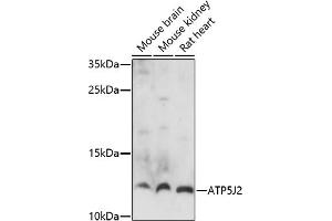 Western blot analysis of extracts of various cell lines, using J2 antibody (ABIN7265725) at 1:1000 dilution. (ATP5J2 antibody)