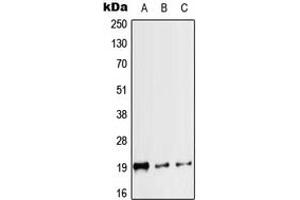 Western blot analysis of Calcitonin expression in HEK293T (A), mouse heart (B), rat heart (C) whole cell lysates. (Calcitonin antibody  (Center))