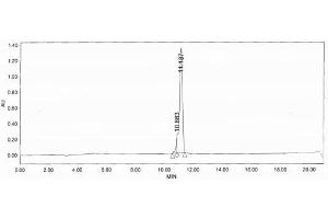 Image no. 1 for Hemochromatosis Type 2 (Juvenile) (HFE2) protein (Ovalbumin) (ABIN1880255) (HFE2 Protein (Ovalbumin))
