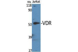 Western Blotting (WB) image for anti-Vitamin D Receptor (VDR) (Tyr307) antibody (ABIN3187461) (Vitamin D Receptor antibody  (Tyr307))
