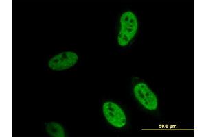 Immunofluorescence of monoclonal antibody to HEYL on HeLa cell. (HEYL antibody  (AA 221-327))