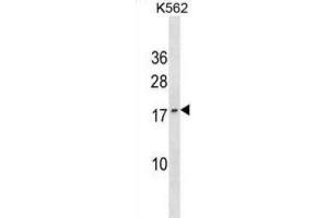 Western Blotting (WB) image for anti-GTP Cyclohydrolase I Feedback Regulator (GCHFR) antibody (ABIN3000608) (GCHFR antibody)