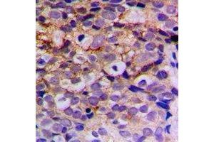 Immunohistochemistry (IHC) image for anti-Presenilin 2 (Alzheimer Disease 4) (PSEN2) antibody (ABIN7308236) (Presenilin 2 antibody)
