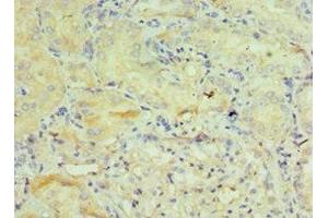Immunohistochemistry of paraffin-embedded human kidney tissue using ABIN7154113 at dilution of 1:100 (GSTO2 antibody  (AA 124-243))