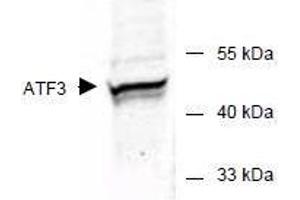 Image no. 2 for anti-Activating Transcription Factor 3 (ATF3) (AA 113-130) antibody (ABIN401262) (ATF3 antibody  (AA 113-130))