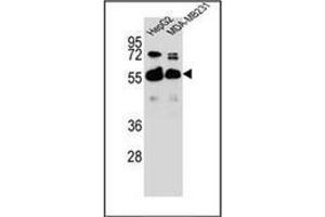 Western blot analysis of RAP1GDS1 Antibody  in HepG2,MDA-MB231 cell line lysates (35ug/lane). (RAP1GDS1 antibody  (Middle Region))