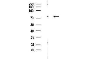 anti-Arachidonate 5-Lipoxygenase (ALOX5) (pSer523) antibody