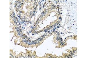 Immunohistochemistry of paraffin-embedded Human prostate using CST1 Polyclonal Antibody at dilution of 1:100 (40x lens). (CST1 antibody)