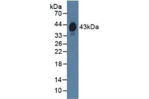 Detection of HPR in Human Serum using Polyclonal Antibody to Haptoglobin Related Protein (HPR) (HPR antibody  (AA 70-332))