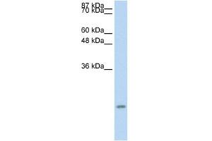 Western Blot showing CCL13 antibody used at a concentration of 1-2 ug/ml to detect its target protein. (CCL13 antibody  (Middle Region))