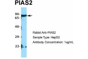 Host:  Rabbit  Target Name:  PIAS2  Sample Type:  HepG2  Antibody Dilution:  1. (PIAS2 antibody  (C-Term))