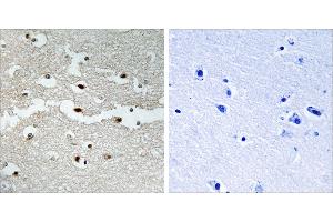 Peptide - +Immunohistochemistry analysis of paraffin-embedded human brain tissue, using BRCA2 antibody.