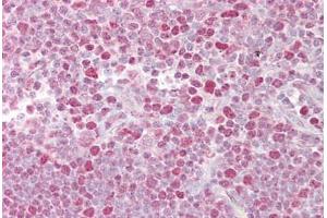 Anti-NFATC2 antibody IHC staining of human thymus. (NFAT1 antibody  (C-Term))
