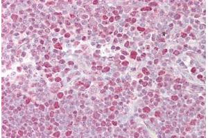 NFAT1 antibody  (C-Term)