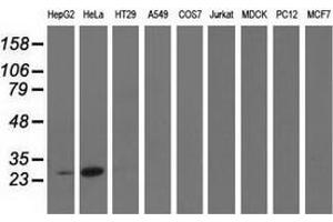 Western blot analysis of extracts (35 µg) from 9 different cell lines by using anti-GSTT2 monoclonal antibody. (GSTT2 antibody)