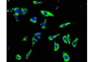 Immunofluorescence staining of HepG2 cells with ABIN7154398 at 1:100, counter-stained with DAPI. (CSF3R antibody  (AA 117-337))
