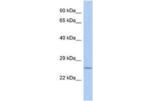 Host:  Rabbit  Target Name:  VAPA  Sample Type:  PANC1 Whole Cell lysates  Antibody Dilution:  1. (VAPA antibody  (C-Term))