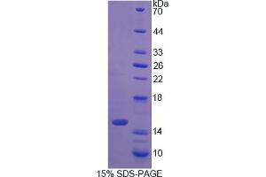 Image no. 1 for S100 Calcium Binding Protein A16 (S100A16) (AA 1-97) protein (His tag) (ABIN4989740)