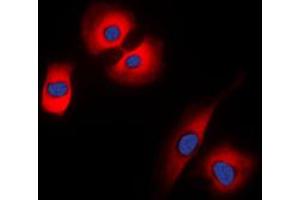 Immunofluorescent analysis of Synaptophysin staining in HeLa cells. (Synaptophysin antibody  (Center))