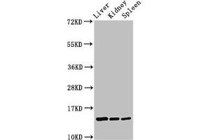 Western Blot Positive WB detected in: Rat liver tissue, Rat kidney tissue, Rat spleen tissue All lanes: CCDC26 antibody at 2. (CCDC26 antibody  (AA 1-109))