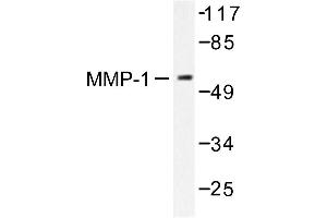 Image no. 1 for anti-Matrix Metallopeptidase 1 (Interstitial Collagenase) (MMP1) antibody (ABIN265522) (MMP1 antibody)