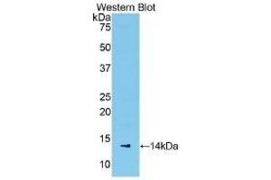 Detection of Recombinant SAA, Mouse using Polyclonal Antibody to Serum Amyloid A (SAA) (SAA antibody  (AA 20-122))