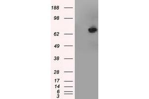 HEK293T cells were transfected with the pCMV6-ENTRY control (Left lane) or pCMV6-ENTRY TTLL12 (Right lane) cDNA for 48 hrs and lysed. (TTLL12 antibody)