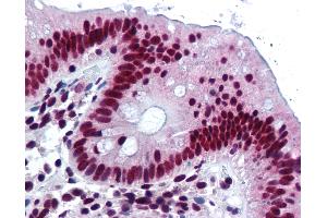 Anti-HNRNPK / hnRNP K antibody IHC of human colon.