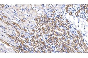 Detection of GPC1 in Mouse Kidney Tissue using Polyclonal Antibody to Glypican 1 (GPC1) (GPC1 antibody  (AA 155-292))