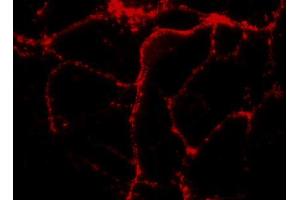 Immunocytochemistry on cultured hippocampus neurons (dilution 1 : 1000). (RAB3A antibody  (AA 2-14))