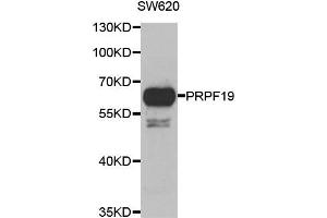 Western blot analysis of extracts of SW620 cell line, using PRPF19 antibody. (PRP19 antibody)