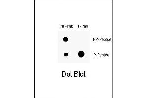 Dot blot analysis of anti-Phospho-P21CIP1- Antibody (ABIN389612 and ABIN2839616) on nitrocellulose membrane. (p21 antibody  (pThr145))