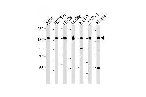 All lanes : Anti-MYO6 Antibody (C-term ) at 1:2000-1:8000 dilution Lane 1: A431 whole cell lysate Lane 2: HC whole cell lysate Lane 3: HT-29 whole cell lysate Lane 4: LNCap whole cell lysate Lane 5: MCF-7 whole cell lysate Lane 6: ZR-75-1 whole cell lysate Lane 7: Human brain lysate Lysates/proteins at 20 μg per lane.