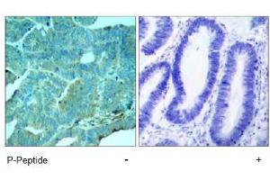Image no. 1 for anti-Eukaryotic Translation Initiation Factor 2-alpha Kinase 2 (EIF2AK2) (pThr446) antibody (ABIN197048) (EIF2AK2 antibody  (pThr446))