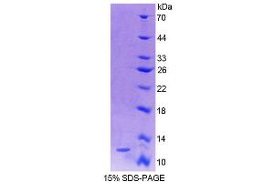 SDS-PAGE analysis of Human S100A4 Protein.