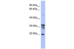 PMM1 antibody used at 1 ug/ml to detect target protein. (PMM1 antibody  (N-Term))