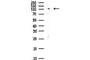 Western blot analysis of lysates from MCF7 cells(heat-shock,45 min treatment), using ACTN4 Antibody at 1/1000 dilution.